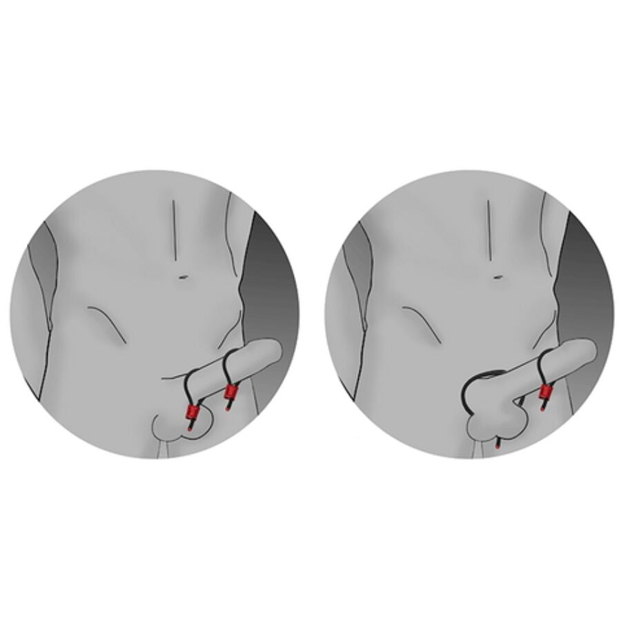 ELECTRASTIM - ANÉIS PENIANOS AJUSTÁVEIS PRESTIGE ELECTRA LOOPS VERMELHOS